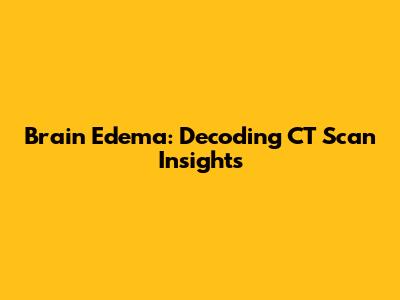 Brain Edema: Decoding CT Scan Insights