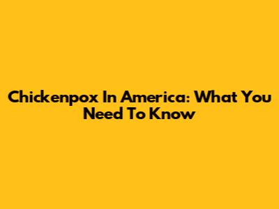 Chickenpox In America: What You Need To Know