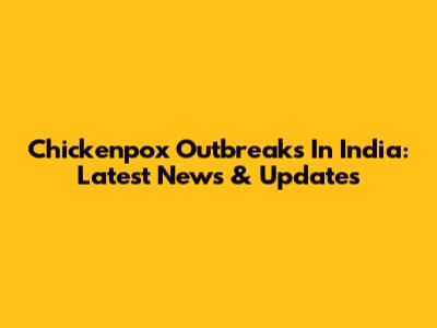 Chickenpox Outbreaks In India: Latest News & Updates