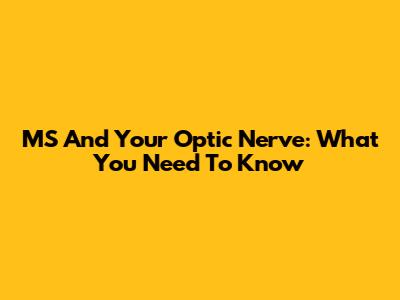 MS And Your Optic Nerve: What You Need To Know